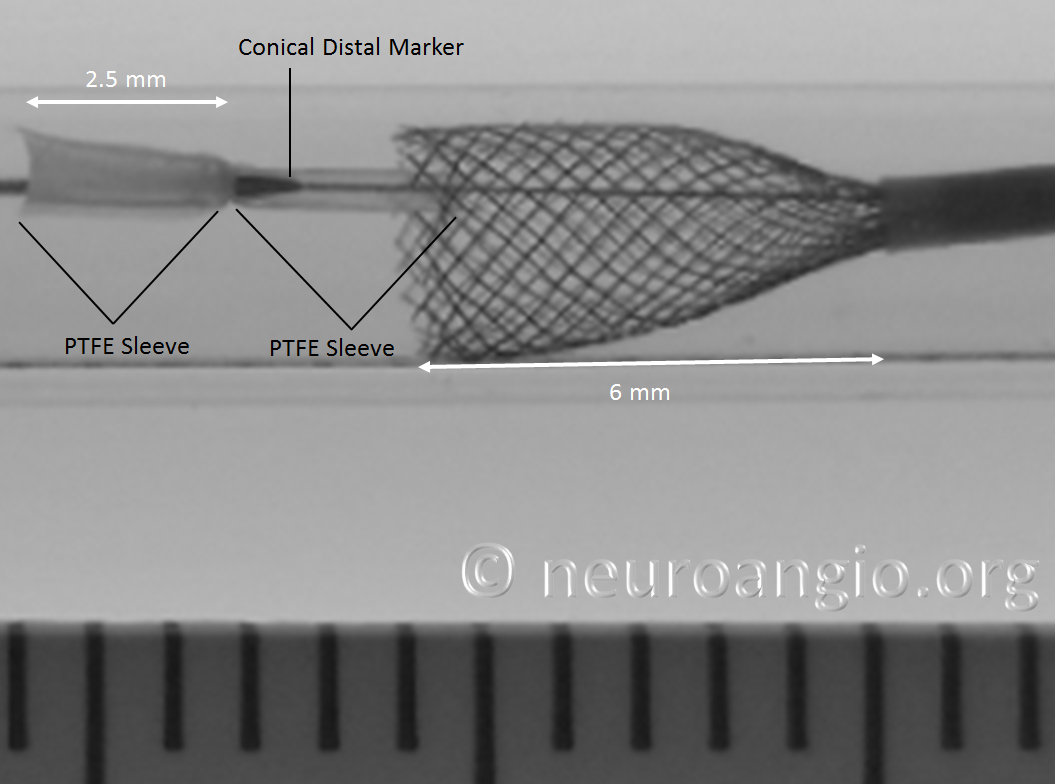 https://neuroangio.org/wp-content/uploads/PED/PED_Flex_Delivery_Tube_8.png