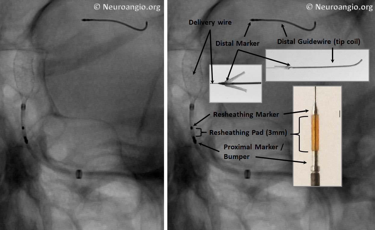 Pipeline Flex Delivery System X-ray