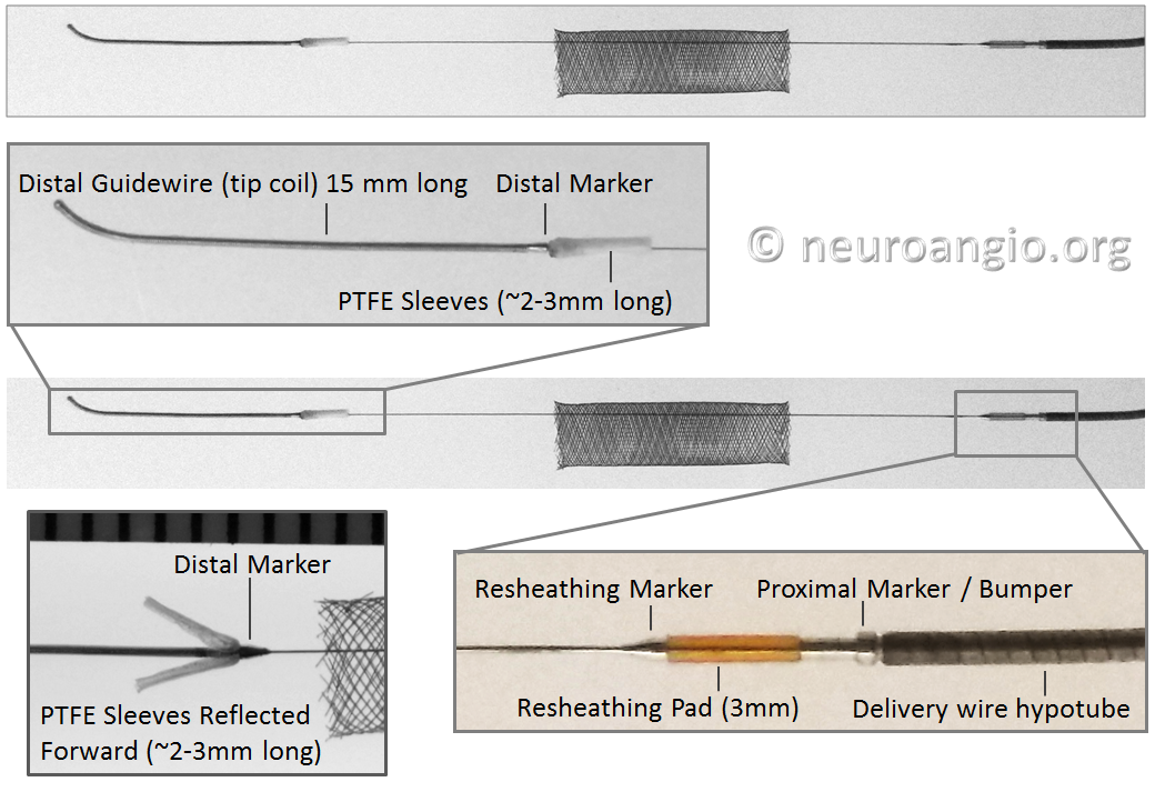 https://neuroangio.org/wp-content/uploads/PED/PED_Flex_System_3.png