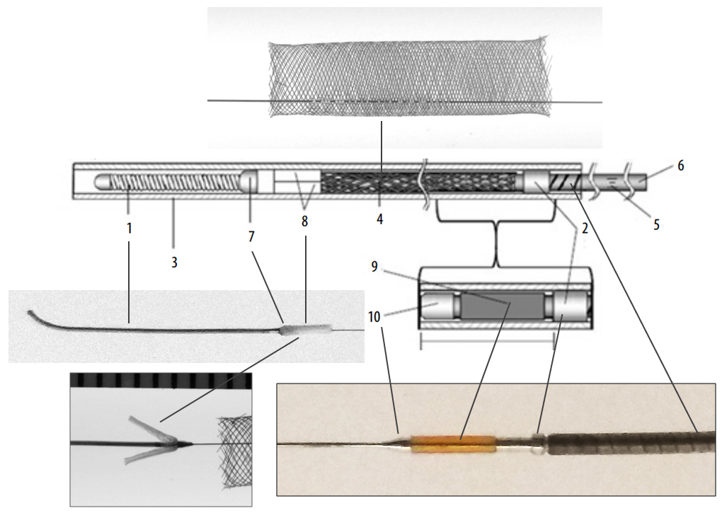 https://neuroangio.org/wp-content/uploads/PED/PED_Flex_System_4.png