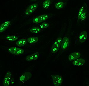 Archivo:ANA NUCLEOLAR 3