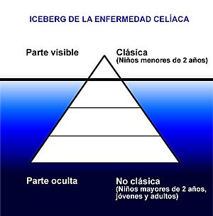 Archivo:IcebergEC