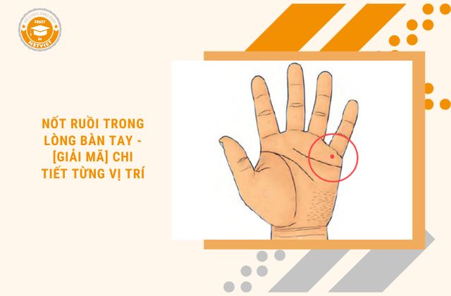 nốt ruồi trong lòng bàn tay