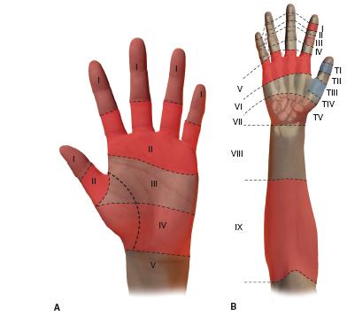 Traumatic Tendon Injuries | Obgyn Key