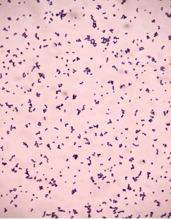 GRAM STAIN – Laboratory Exercises in Microbiology