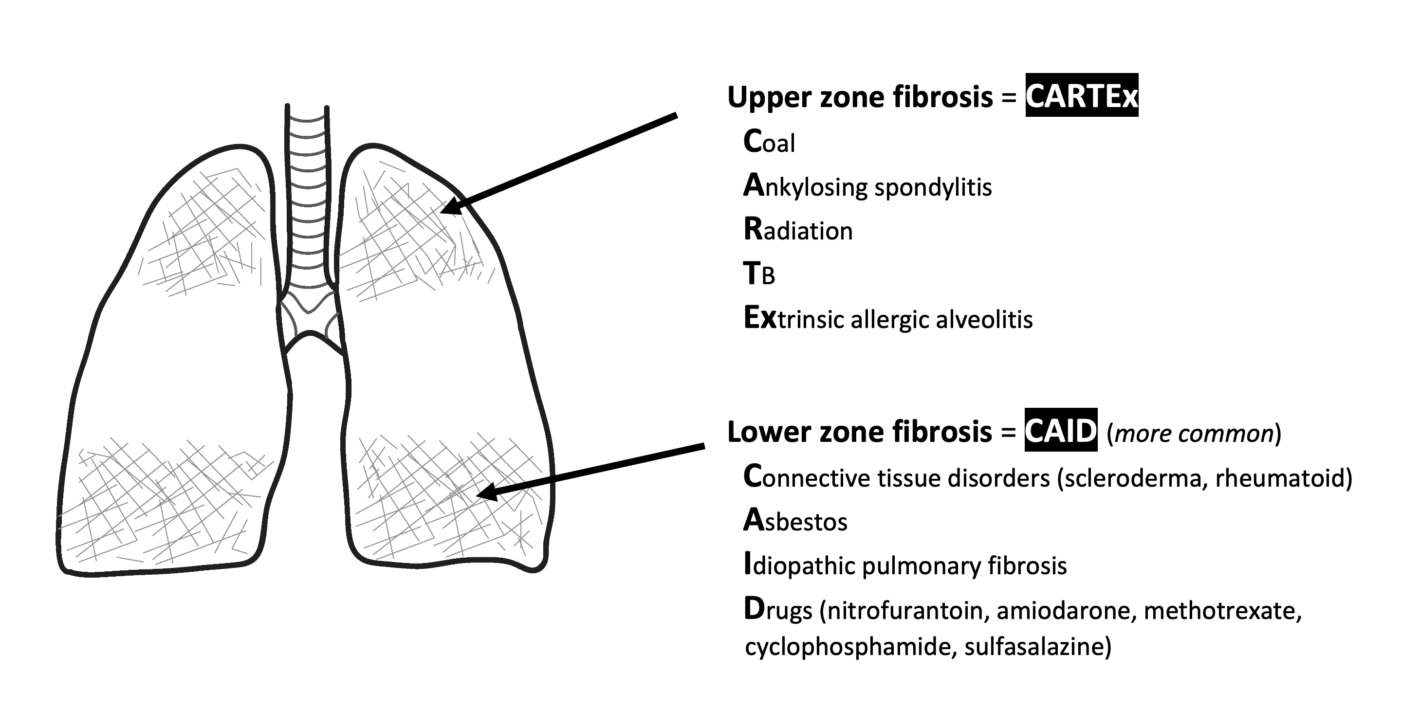 Pulmonary Fibrosis image.