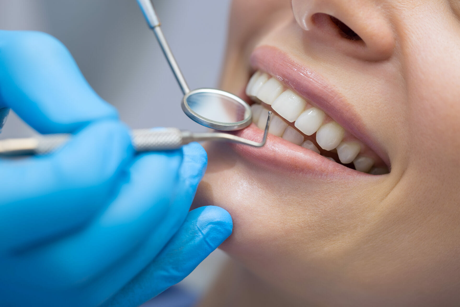 Best Dental Check-Up and Clean in Palm Beach, QLD