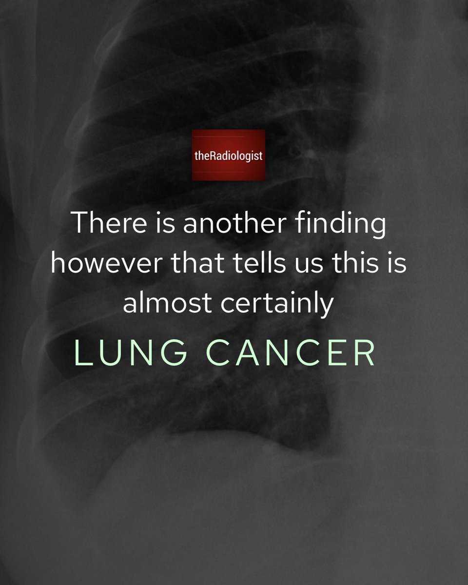 CHEST X RAY QUIZ ️Select the most likely diagnosis on these 10 cases ...