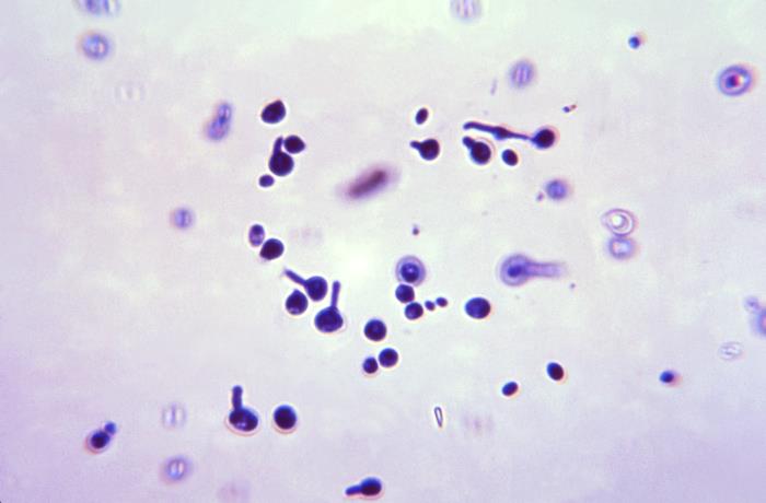 Candida Albicans Gram Stain