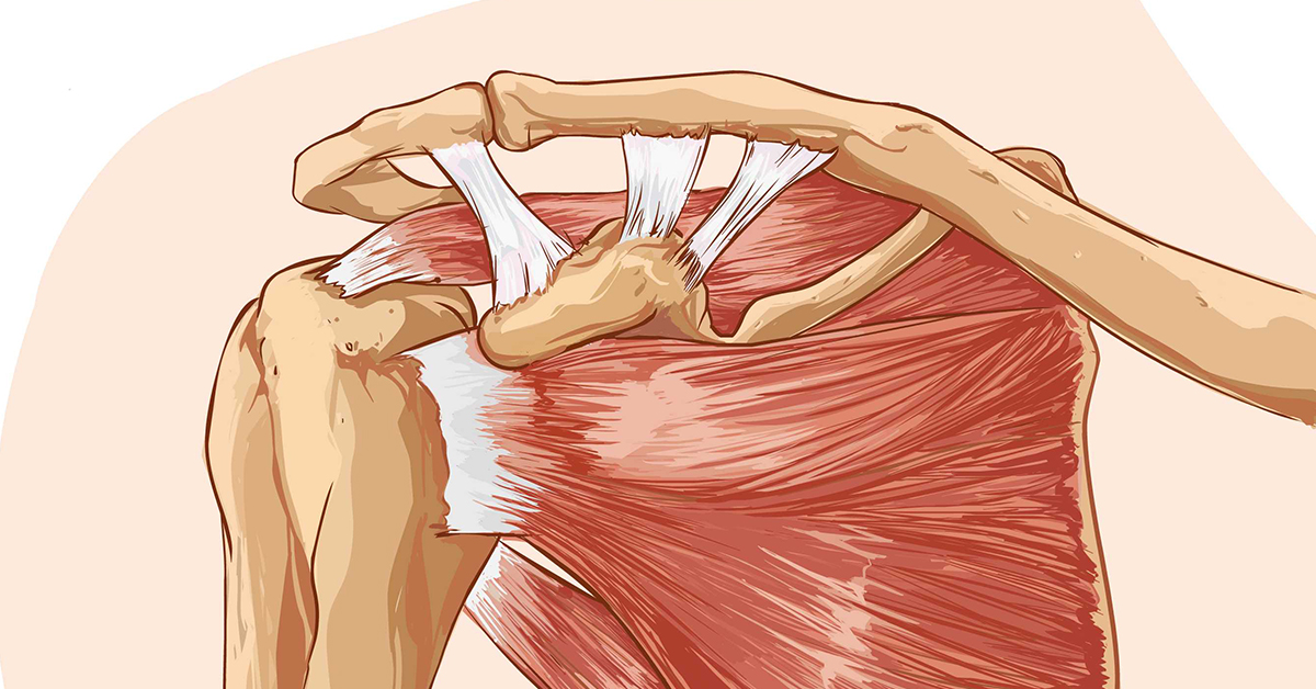 Fracture of the Greater Tuberosity