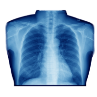 X-rays PNG