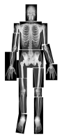 X-rays PNG