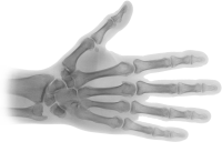 X-rays PNG