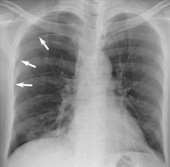 INITIAL ASSESSMENT AND ICU CARE OF THE TRAUMA PATIENT | Pocket Dentistry