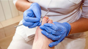 Diabetic Foot Care – Podiatry Assocites