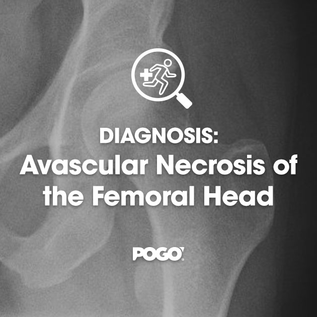 avascular necrosis