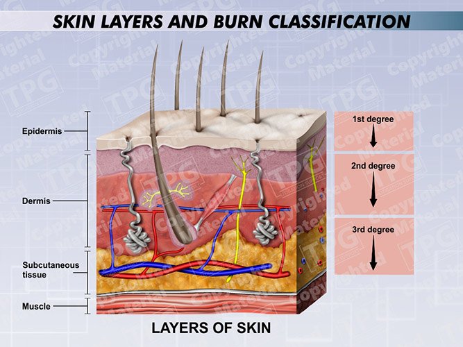 Three Main Layers Of Skin Burns