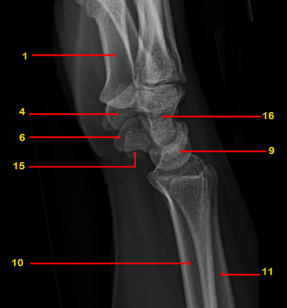 X Ray Wrist Lateral View