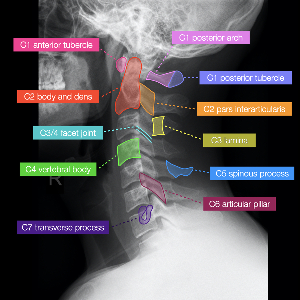 Normal Radiographic Anatomy Of The Cervical Spine Anatomy Medica ...