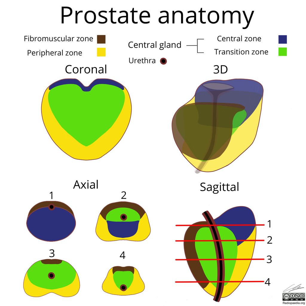 Prostate Zonal Anatomy Anatomical Charts Posters - vrogue.co