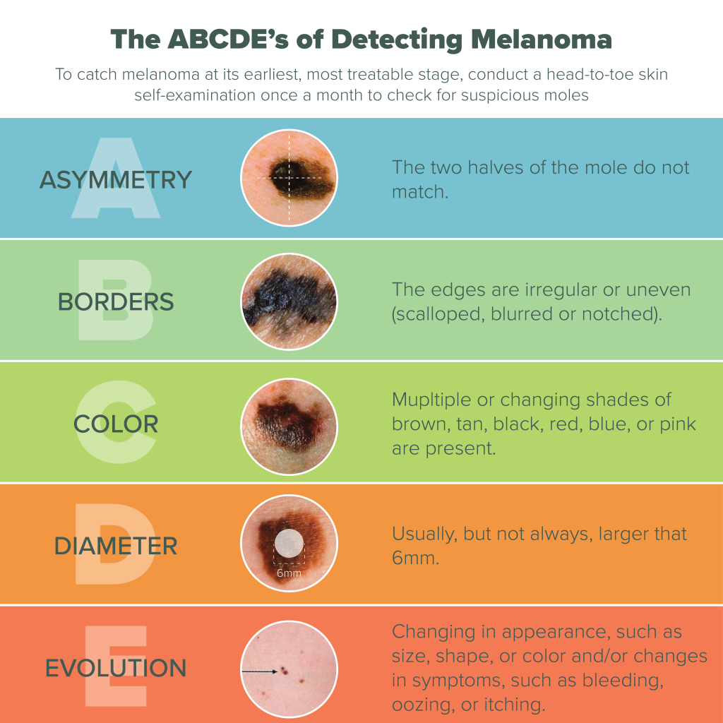 Pink Melanoma Symptoms