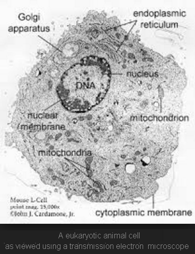 Diagram Of Plant Cell Under Electron Microscope Diagram Sketch | My XXX ...