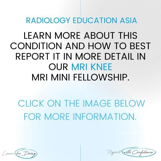 knee-msk-mri-learn-radiology-online-course-radedasia.jpg