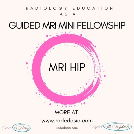 learn-mri-radiology-hip-radedasia.jpg