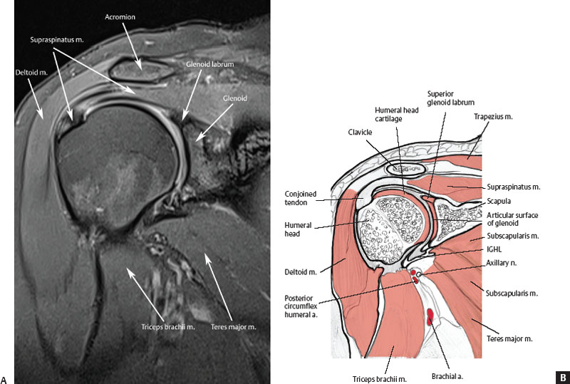 Conjoined Tendon Shoulder Anatomy Capsular Attachment - vrogue.co