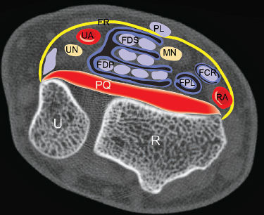 Wrist Flexor Anatomy