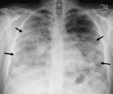 32 | Radiology Key