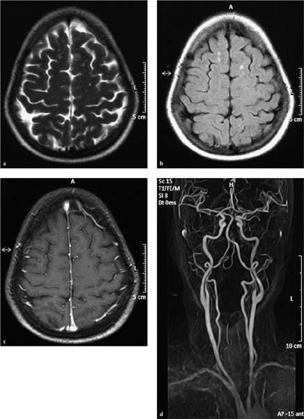 Vascular System | Radiology Key