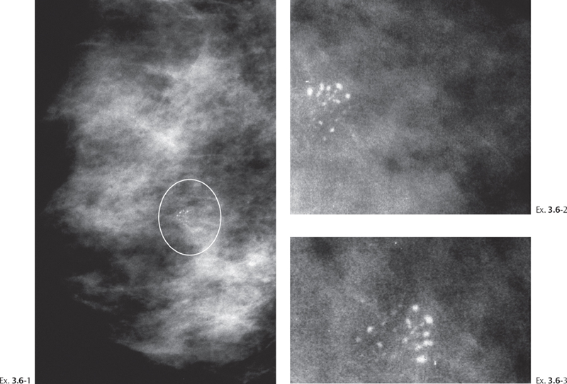 Figure 1 From Classification Of Malignant And Benign - vrogue.co