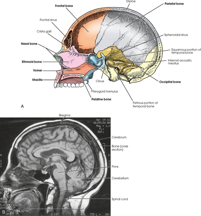 Exact paranteză avea skull mri bone anatomy lamina elev Fotoelectric ...