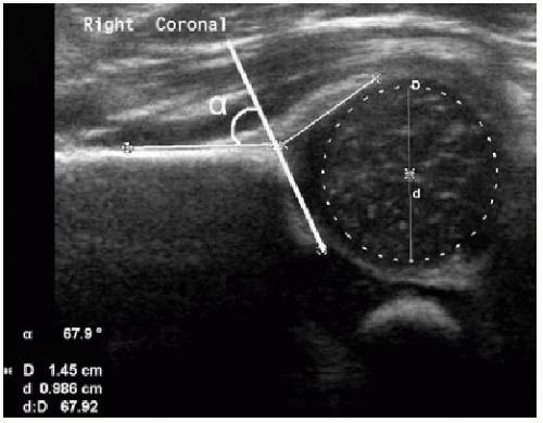 Hip Disorders Radiology Key