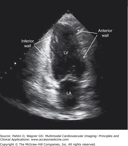 Echocardiography | Radiology Key