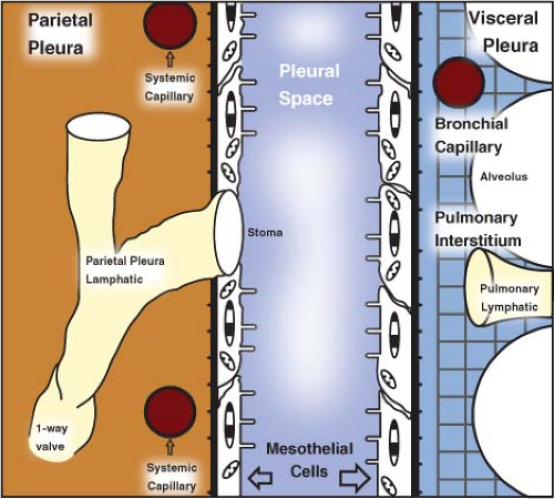 Pleural Effusion Pathophysiology