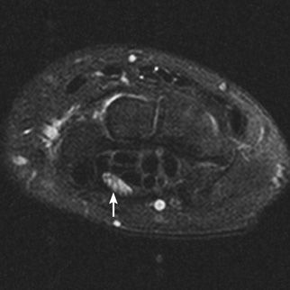 Cases | Radiology Key