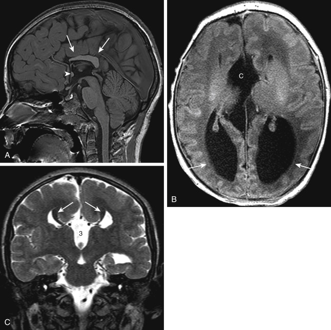 Neuro | Radiology Key