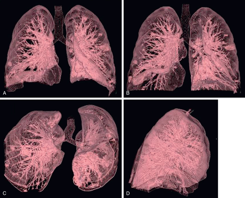 Lung Anatomy Netter Google Search Lung Anatomy Human - vrogue.co