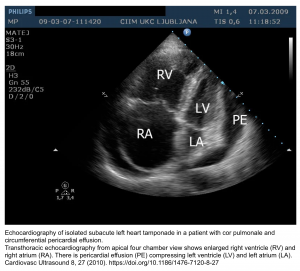 Pulmonary Hypertension: From Diagnosis To Critical Management In The ...