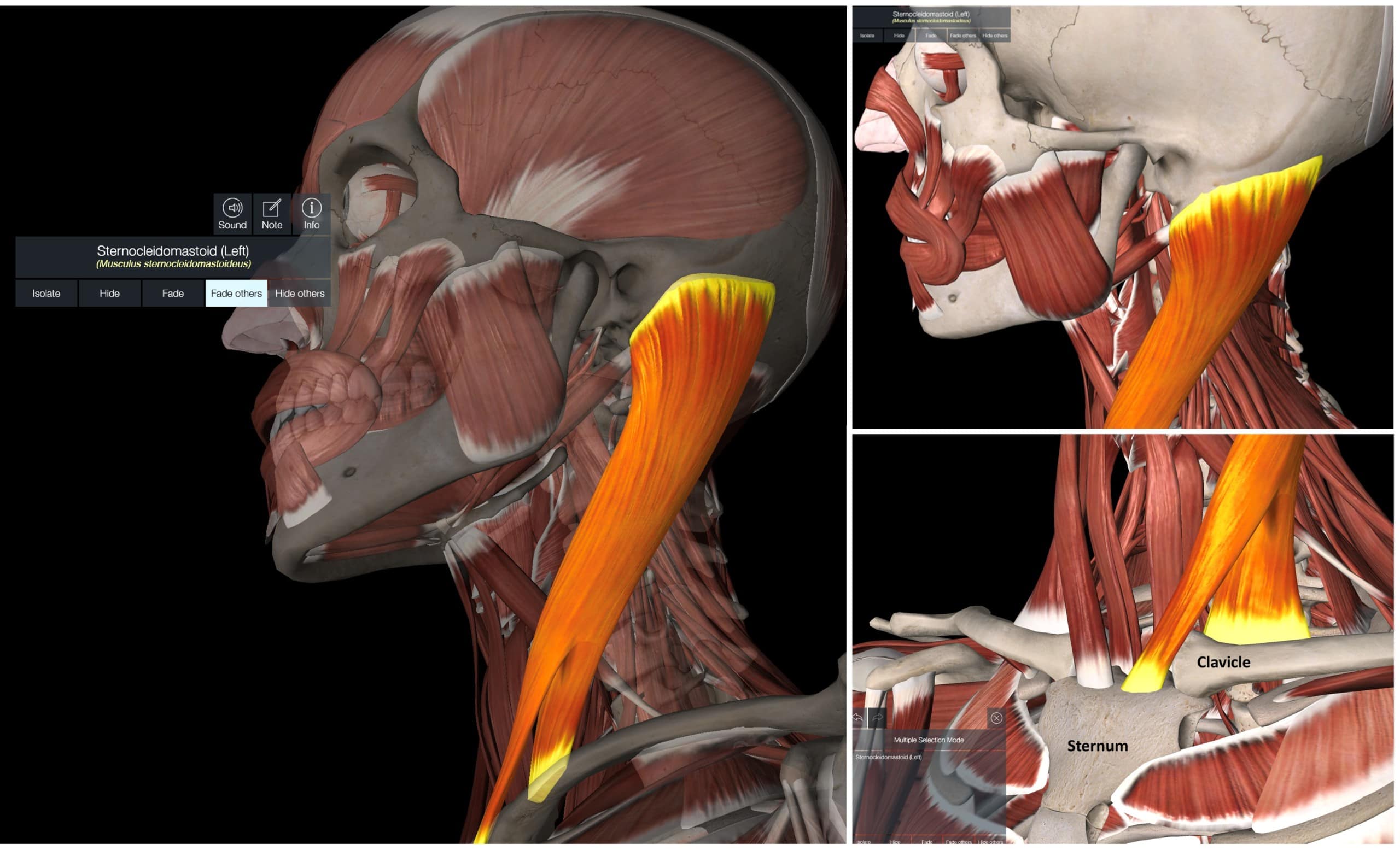 Sternocleidomastoid Muscle Pain