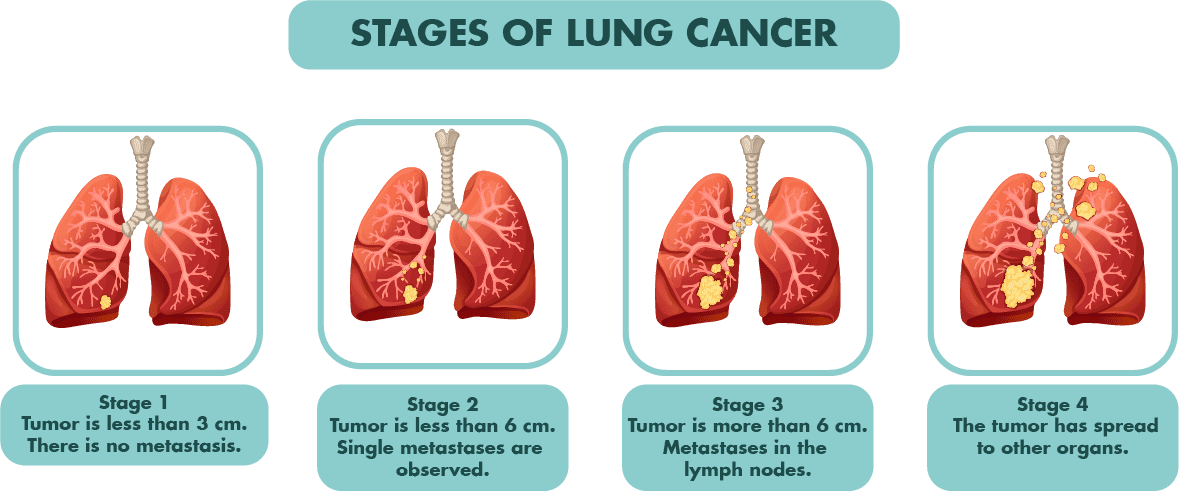 Cancer Caregivers: Getting Support Through The Cancer Journey - human