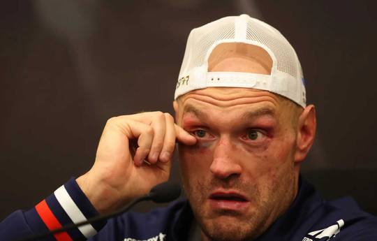 Tyson Fury Retires From Boxing at the Age of 36 After Losing To Usyk Twice