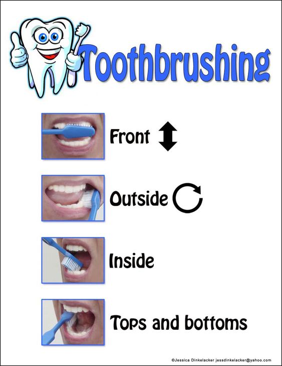 toothbrushing visual aid | AU-Some April | Pinterest | Autistic ...