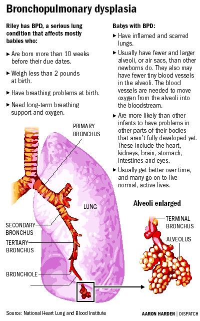 17 Best images about Medical Conditions on Pinterest | Heart disease ...