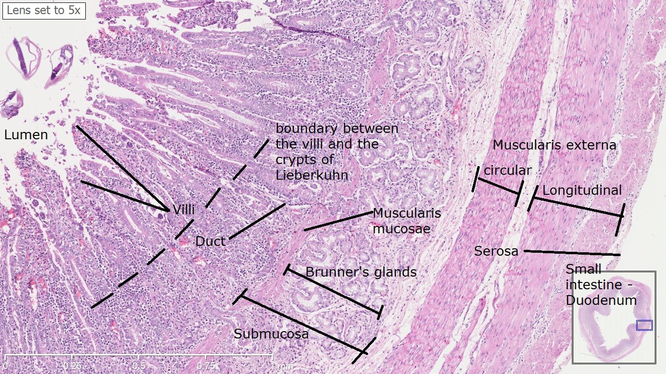 Histology Slides Database Histological Diagram Of Duodenum | My XXX Hot ...