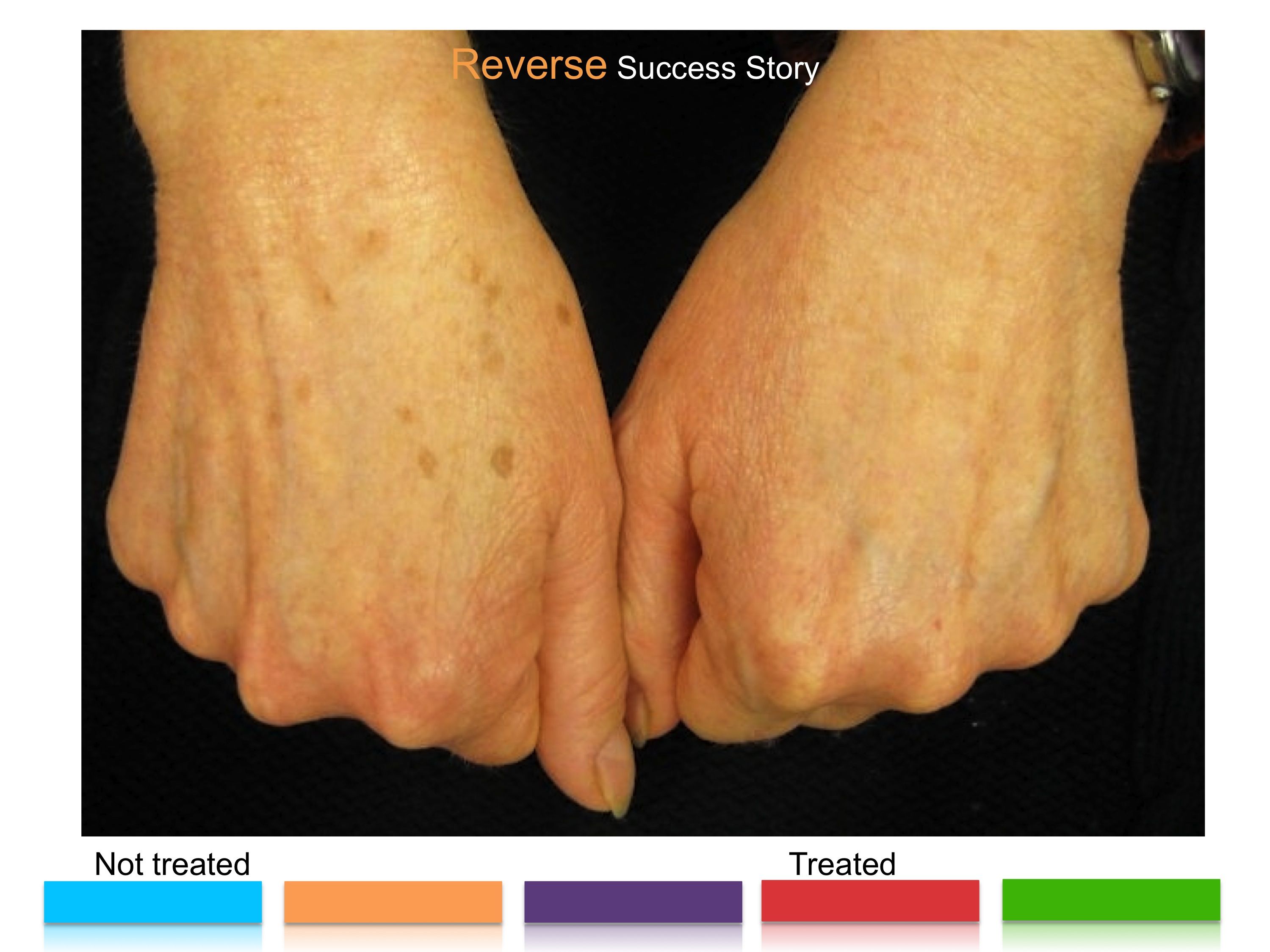 get-rid-of-those-brown-spots-on-your-hands-and-arms-ask-me-how