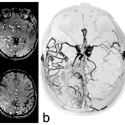 3D-TOF images.