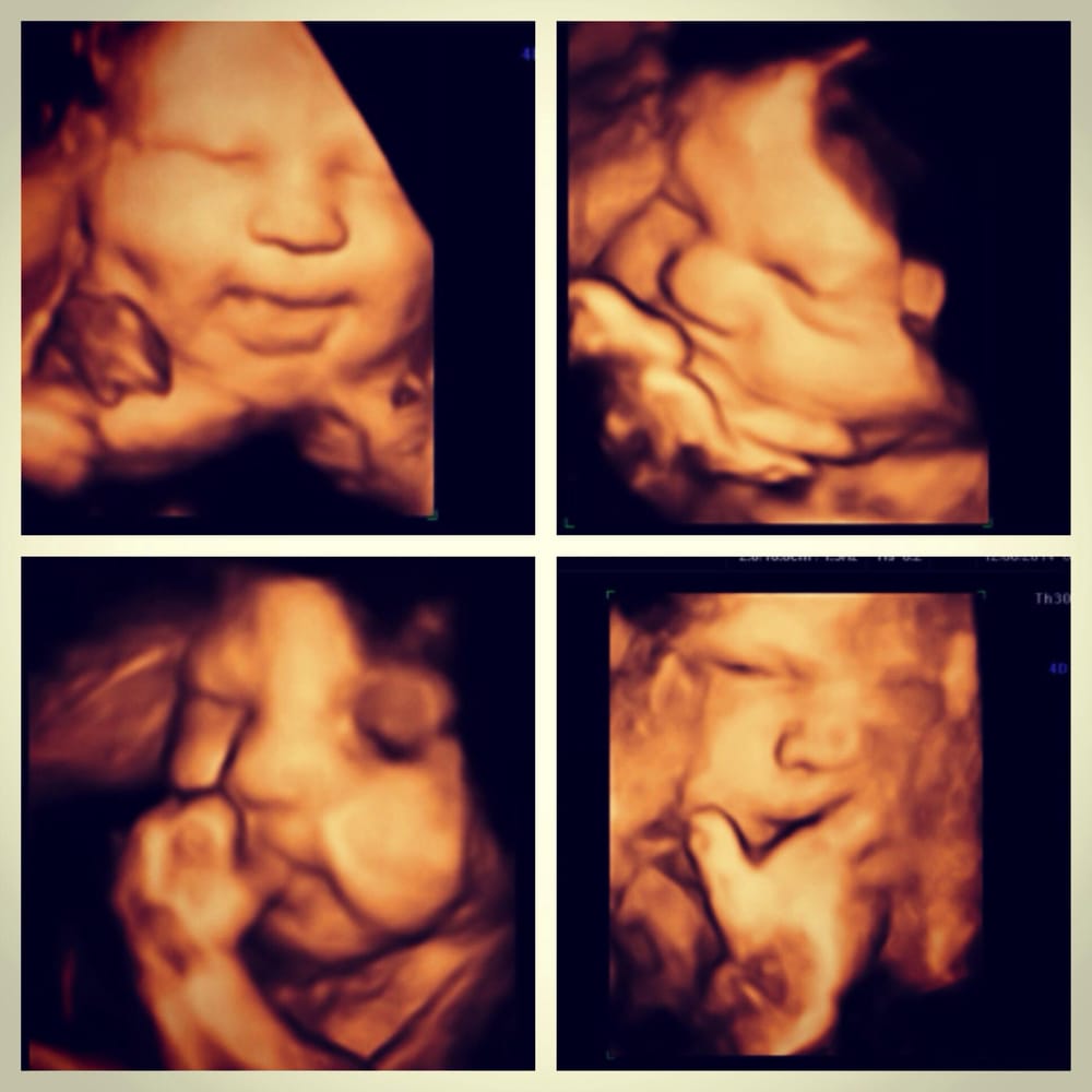 30 weeks pregnant 4d ultrasound - nibhtwc